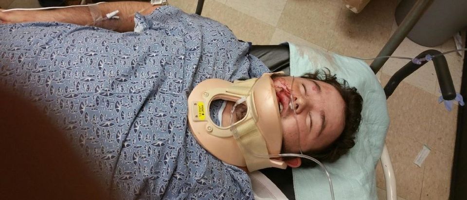 Alabama Teen Beaten Into Critical Condition After Posting &lsquo;Blue Lives Matter&rsquo;