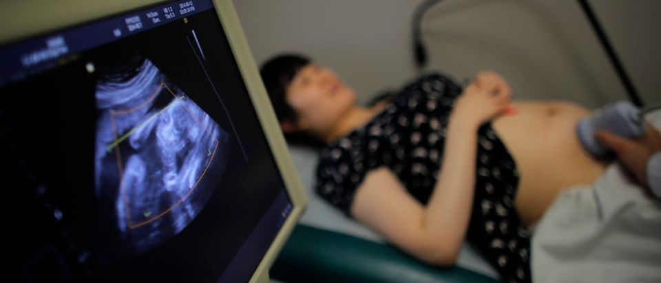 Wu Tianyang, who is five month pregnant with her second child, attends a sonogram at a local hospital in Shanghai September 12, 2014. REUTERS/Carlos Barria