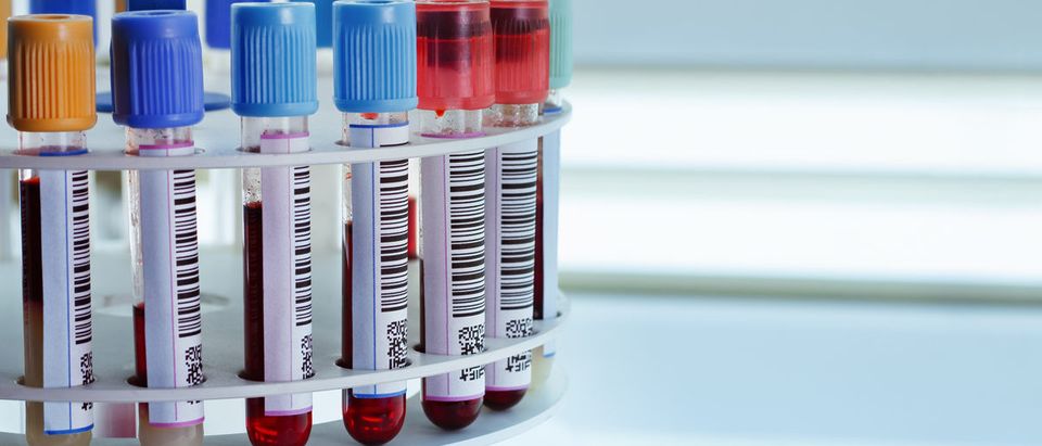 tubes prepared in lab centrifuge machine blood bank bloodtesttubelabmedicallaboratorysampledevicebiotechnologybiomedicalmachinecentrifugelabeldnahealthcarebiochemistryplasmasciencescientisthospitalequipmentrobotserumspeedresearchtraymanipulationanalysisappliancesbiologyblood bankcarecarouselchemicalclinicalcontainercopyspaceexperimenthealthinstrumentmedicinepharmacyplacerotatescientificshakespintechnologytoolShow more(Shutterstock)