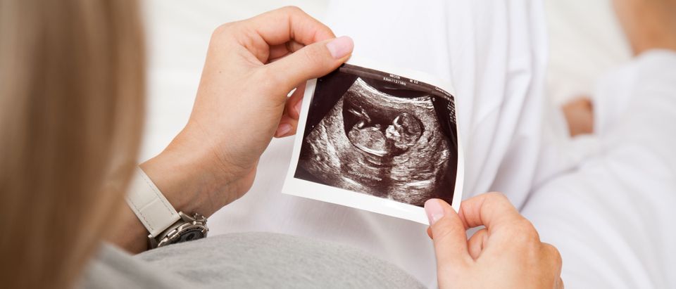 Pregnant woman looking at ultrasound picture, Shutterstock