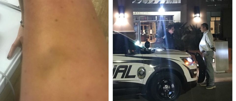 'Stop Hurting Me!'- Soros-Funded Male Democratic Operative Arrested For Assaulting Female Campaign Manager, Leaving Bruises (Photos obtained by TheDCNF)