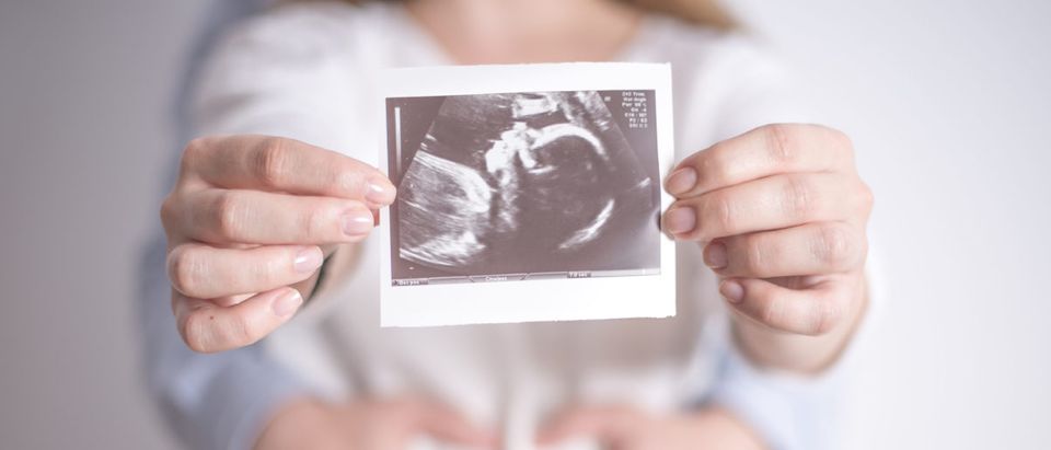 Missouri House passed an abortion bill. VeeX, Shutterstock