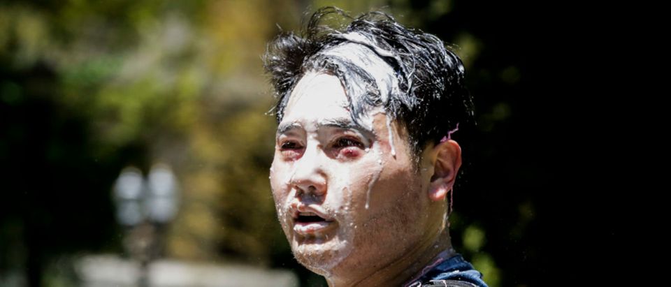 Andy Ngo, a Portland-based journalist, is seen covered in unknown substance after unidentified Rose City Antifa members attacked him on June 29, 2019 in Portland, Oregon. (Moriah Ratner/Getty Images)