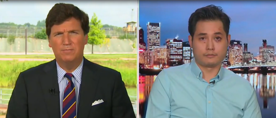 Tucker Carlson interviews Andy Ngo after Antifa attack (Fox News screengrab)