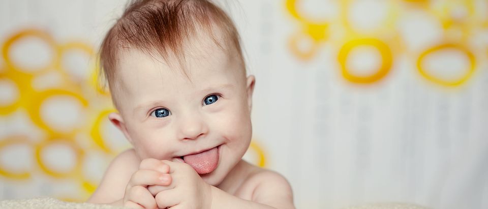 cheerful little baby girl with Downs Syndrome