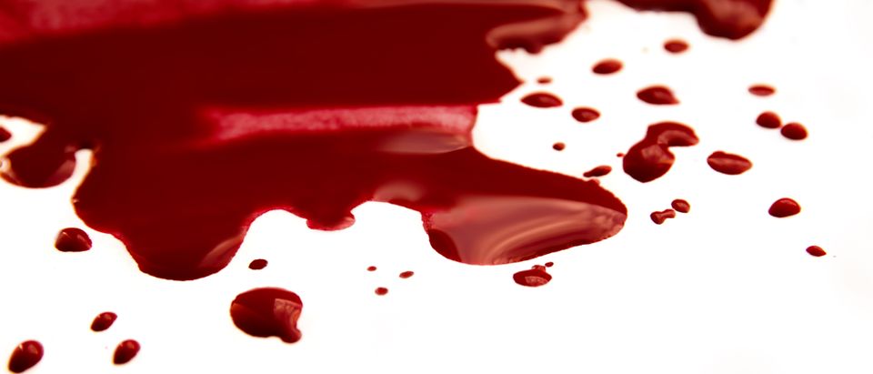 Blood. (Shutterstock/Oksana Mizina)