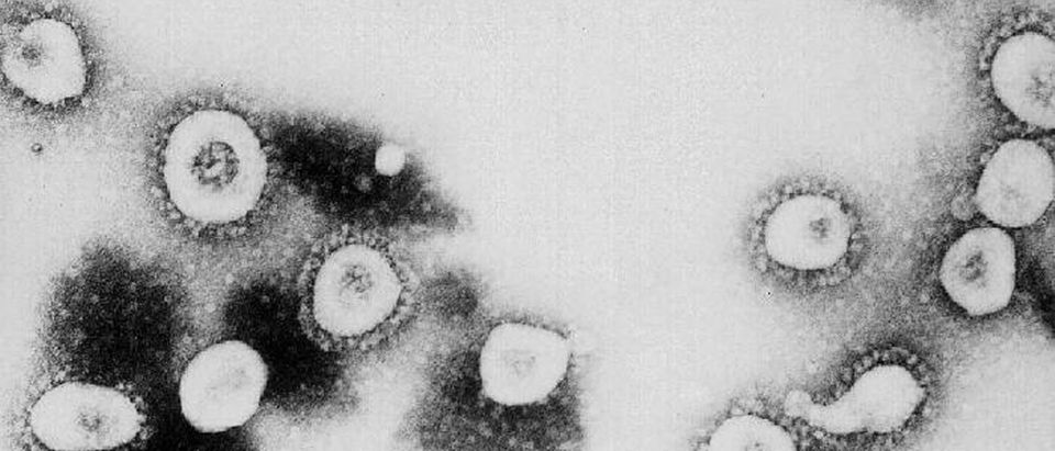 CDC Says SARS Might Be A Form Of The Coronavirus