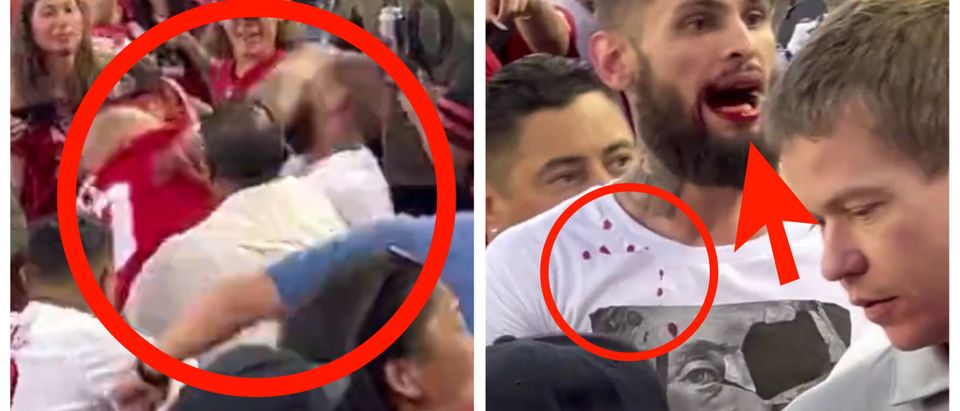 Fans Left Bloodied After Massive Brawl In The Stands During 49ers